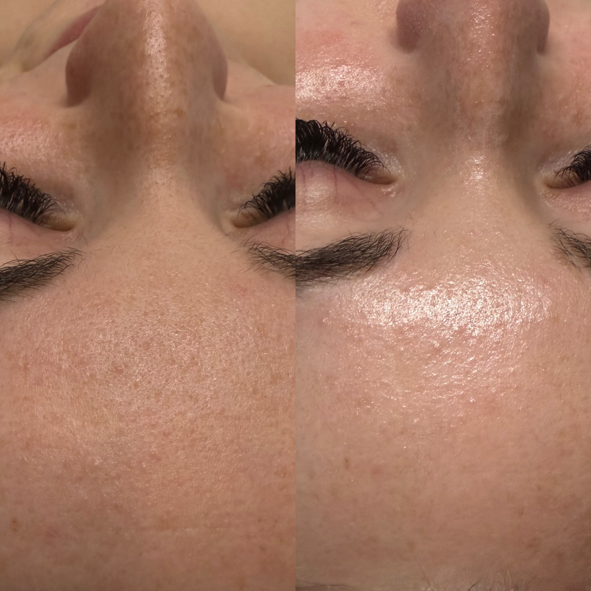 before and after skincare